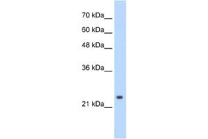 CPSF4 antibody used at 0. (CPSF4 antibody  (C-Term))