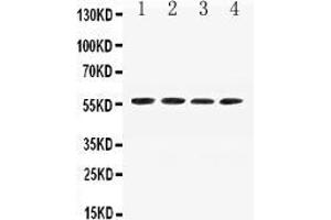 Western blot analysis of Angiotensinogen expression in mouse liver extract ( Lane 1), mouse spleen extract ( Lane 2), mouse testis extract ( Lane 3) and mouse kidney extract ( Lane 4). (AGT antibody  (AA 25-115))