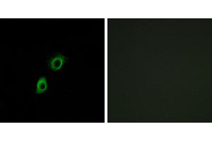 Peptide - +Western blot analysis of extracts from HT-29 cells, using INSL4 antibody. (INSL4 antibody)