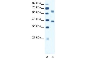 WB Suggested Anti-RRN3 Antibody Titration:  1. (RRN3 antibody  (Middle Region))