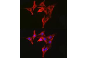 Immunofluorescence analysis of NIH-3T3 cells using α-Tubulin Mouse mAb (ABIN7271035) at dilution of 1:100 (40x lens). (TUBA4A antibody)