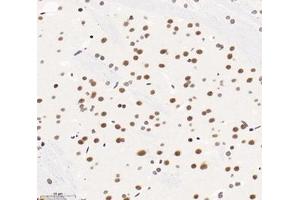 Immunohistochemistry analysis of paraffin-embedded mouse brain using,SNRPD2 (ABIN7075634) at dilution of 1: 1600 (SNRPD2 antibody)