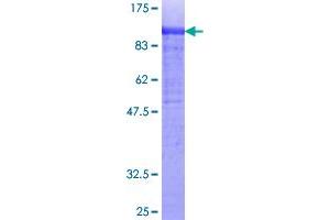 COL14A1 Protein (AA 1-759) (GST tag)