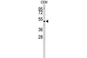 Western blot analysis of CNDP1 Antibody (C-term) in CEM cell line lysates (35µg/lane). (CNDP1 antibody  (C-Term))