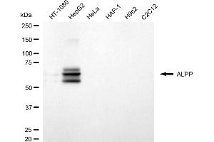Western blotting analysis using ALPP antibody (ABIN7799843).
