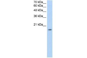 WB Suggested Anti-ZNF580 Antibody Titration:  0.