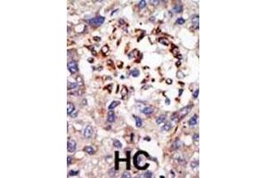 Immunohistochemistry (IHC) image for anti-Chromobox Homolog 8 (CBX8) antibody (ABIN3001538) (CBX8 antibody)