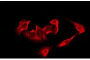 ABIN6278224 staining HuvEc by IF/ICC. (CDK5R2 antibody  (Internal Region))