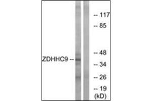 Western blot analysis of extracts from COLO cells, using ZDHHC9 Antibody . (ZDHHC9 antibody  (C-Term))