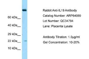 Western Blotting (WB) image for anti-Interleukin 19 (IL19) (Middle Region) antibody (ABIN2789718) (IL-19 antibody  (Middle Region))