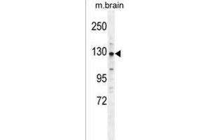 CYLN2 Antibody (C-term) (ABIN1537648 and ABIN2849319) western blot analysis in mouse brain tissue lysates (35 μg/lane). (CLIP2 antibody  (C-Term))