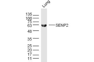 Mouse lung lysates probed with SENP2 Polyclonal Antibody, unconjugated  at 1:300 overnight at 4°C followed by a conjugated secondary antibody for 60 minutes at 37°C. (SENP2 antibody  (AA 1-100))