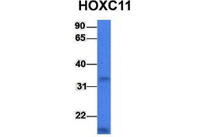 Host:  Rabbit  Target Name:  HOXC11  Sample Type:  721_B  Antibody Dilution:  1. (HOXC11 antibody  (Middle Region))