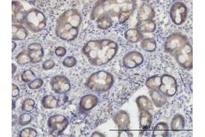 Image no. 2 for anti-Oxidative-Stress Responsive 1 (OXSR1) (AA 1-528) antibody (ABIN599107) (OXSR1 antibody  (AA 1-528))