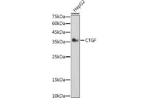 Western blot analysis of extracts of HepG2 cells, using CTGF antibody (ABIN6127716, ABIN6139187, ABIN6139190 and ABIN6215053) at 1:1000 dilution. (CTGF antibody  (AA 27-349))