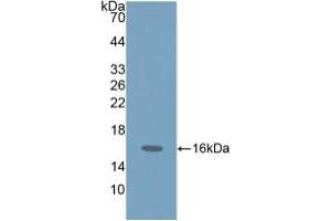Detection of Recombinant ProGRP, Human using Polyclonal Antibody to Pro-Gastrin Releasing Peptide (ProGRP) (ProGRP antibody  (AA 54-148))