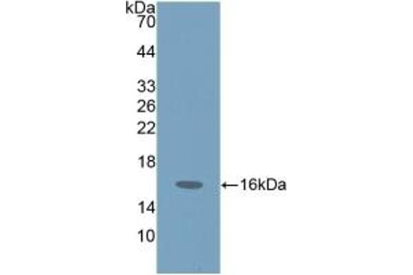 ProGRP 抗体  (AA 54-148)