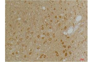 Immunohistochemistry (IHC) analysis of paraffin-embedded Rat Brain Tissue using GABA A Receptor alpha3 Rabbit Polyclonal Antibody diluted at 1:200. (GABRA3 antibody)