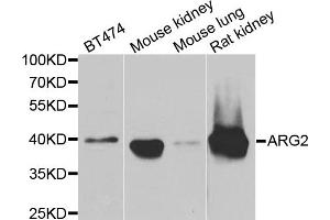 Western blot analysis of extracts of various cell lines, using ARG2 antibody. (ARG2 antibody)