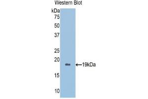 Detection of Recombinant PRDX5, Human using Polyclonal Antibody to Peroxiredoxin 5 (PRDX5) (Peroxiredoxin 5 antibody  (AA 1-162))