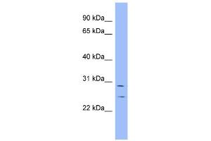 WB Suggested Anti-HEY1 Antibody Titration:  0. (HEY1 antibody  (N-Term))
