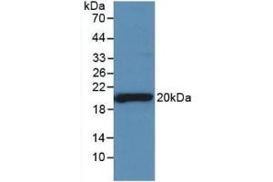 Detection of Recombinant SHBG, Rat using Monoclonal Antibody to Sex Hormone Binding Globulin (SHBG) (SHBG antibody  (AA 222-358))