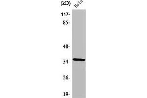 Western Blot analysis of HeLa cells using ZIS Polyclonal Antibody (ZNF265 antibody  (Internal Region))
