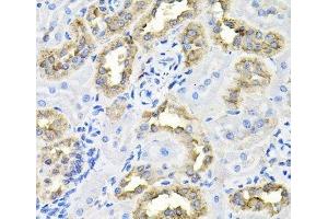 Immunohistochemistry of paraffin-embedded Rat kidney using CDCA8 Polyclonal Antibody at dilution of 1:100 (40x lens). (CDCA8 antibody)