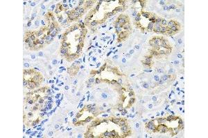 Immunohistochemistry of paraffin-embedded Rat kidney using CDCA8 Polyclonal Antibody at dilution of 1:100 (40x lens).