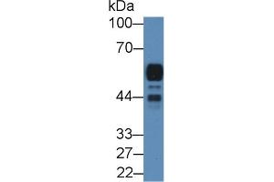 Detection of AMY2A in Rat Pancreas lysate using Polyclonal Antibody to Amylase, Alpha 2A (AMY2A) (AMY2A antibody  (AA 201-473))