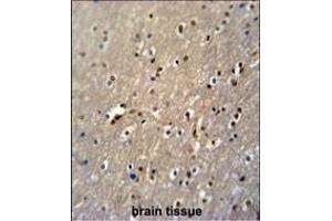 Immunohistochemistry (Paraffin-embedded Sections) (IHC (p)) image for anti-PAP Associated Domain Containing 4 (PAPD4) (AA 58-87), (N-Term) antibody (ABIN651284)