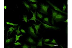 Immunofluorescence of monoclonal antibody to RING1 on HeLa cell. (RING1 antibody  (AA 81-170))