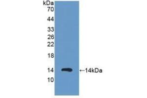 Detection of Recombinant PKIa, Human using Polyclonal Antibody to Protein Kinase Inhibitor Alpha (PKIa) (PKIA antibody  (AA 13-71))