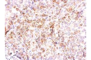 IHC-P Image CCR8 antibody detects CCR8 protein at membrane on A549 xenograft by immunohistochemical analysis.