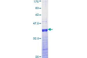 JunD Protein (AA 258-347) (GST tag)