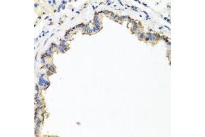 Immunohistochemistry of paraffin-embedded rat lung using CXCR4 antibody at dilution of 1:100 (x40 lens). (CXCR4 antibody)