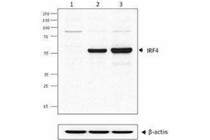 Western Blotting (WB) image for anti-Interferon Regulatory Factor 4 (IRF4) antibody (ABIN2665206) (IRF4 antibody)