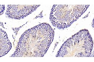 Detection of PTPN5 in Mouse Testis Tissue using Polyclonal Antibody to Protein Tyrosine Phosphatase, Non Receptor Type 5 (PTPN5) (PTPN5 antibody  (AA 270-533))