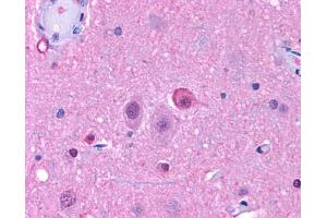 Anti-NPY5R antibody IHC of human brain, neurons and glia. (NPY5R antibody  (Cytoplasmic Domain))