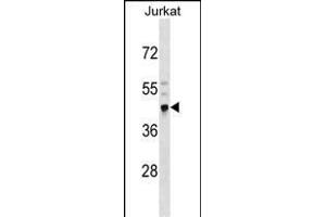 CRELD2 Antibody (N-term) (ABIN1539207 and ABIN2850367) western blot analysis in Jurkat cell line lysates (35 μg/lane). (CRELD2 antibody  (N-Term))