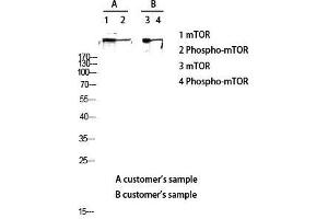 Western Blot (WB) analysis of lysis using Phospho-mTOR (S2448) antibody. (MTOR antibody  (pSer2448))