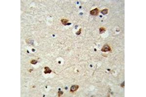 Immunohistochemistry (IHC) image for anti-Ribosomal Protein S6 Kinase, 70kDa, Polypeptide 2 (RPS6KB2) antibody (ABIN3032485)