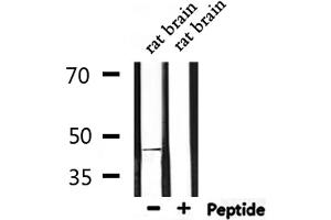 Western blot analysis of extracts from rat brain, using Beta Arrestin 2 Antibody. (Arrestin 3 antibody  (C-Term))