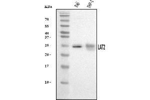 Western blot analysis of NTAL/LAT2 using anti-NTAL/LAT2 antibody (ABIN7601793).