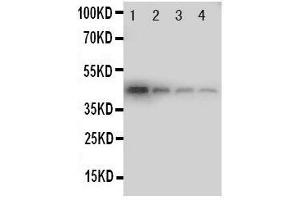 Lane 4: Recombinant Human DDR1 Protein 1.