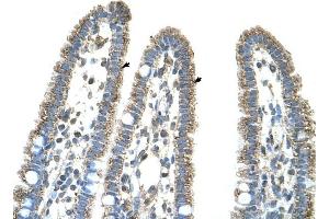 CPS1 antibody was used for immunohistochemistry at a concentration of 4-8 ug/ml to stain Epithelial cells of intestinal villus (arrows) in Human Intestine. (CPS1 antibody  (Middle Region))