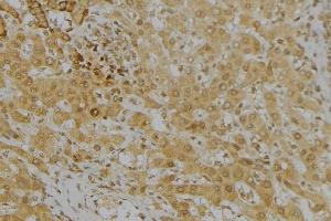 ABIN6272962 at 1/100 staining Mouse liver tissue by IHC-P. (KMO antibody  (Internal Region))
