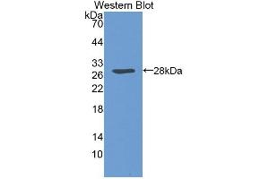Western blot analysis of recombinant Human SCCA1. (SCCA1 antibody  (AA 1-210))
