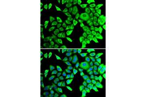 Immunofluorescence analysis of  cells using THADA antibody (ABIN6133115, ABIN6149103, ABIN6149104 and ABIN6222943). (THADA antibody  (AA 1684-1953))