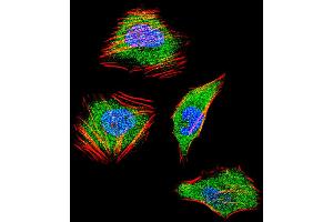 Fluorescent confocal image of Hela cell stained with SMAD4 Antibody . (SMAD4 antibody  (C-Term))